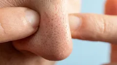 Dieses Problem beschäftigt viele, aber nicht alle wissen, dass es sich ganz einfach lösen lässt.